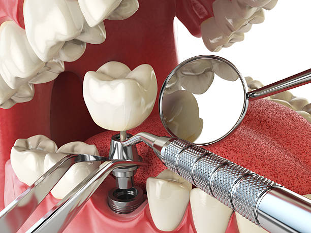 Best Emergency Dental Surgery in Jay, OK